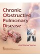 Chronic Obstructive Pulmonary Disease (Pb 2019)