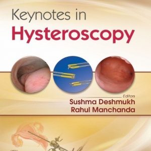 Keynotes In Hysteroscopy (Pb 2019)