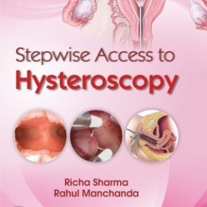 STEPWISE ACCESS TO HYSTEROSCOPY (HB 2020) 
