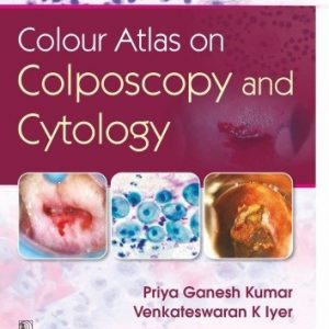 Colour Atlas On Colposcopy And Cytology Hb 2020