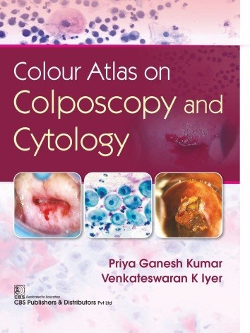9789389688603 1 | Colour Atlas On Colposcopy And Cytology Hb 2020 | 9789389688603 | Together Books Distributor COLOUR ATLAS ON COLPOSCOPY AND CYTOLOGY (HB 2020)