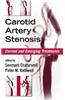 Carotid Artery Stenosis Current And Emerging Treatments