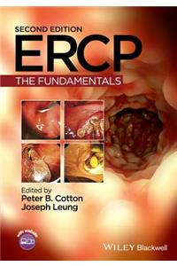 Ercp The Fundamentals 2Ed (Hb 2015)