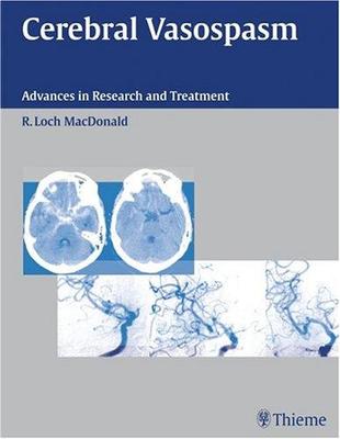 9781588902832 1 | Cerebral Vasospasm | 9781588902832 | Together Books Distributor Cerebral Vasospasm