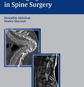 Challenging Cases in Spine Surgery