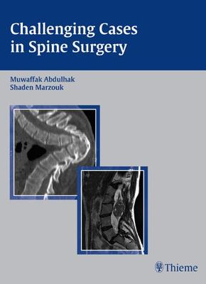9781588903938 1 | Challenging Cases In Spine Surgery | 9781588903938 | Together Books Distributor Challenging Cases in Spine Surgery