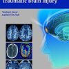Imaging of Traumatic Brain Injury