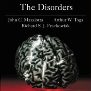 Brain Mapping The Disorders