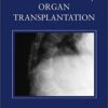 9780121835026 | BONE DISEASE OF ORGAN TRANSPLANTATION (HB 2005) | 9780122270109 | Together Books Distributor