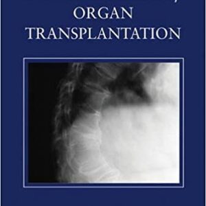 Bone Disease Of Organ Transplantation Hb 2005