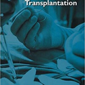 Practical Manual Of Abdominal Organ Transplantation
