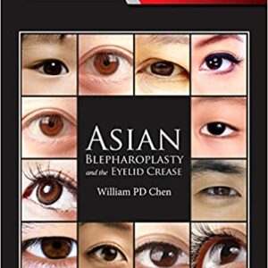 Asian Blepharoplasty And The Eyelid Crease 3Ed Hb 2016