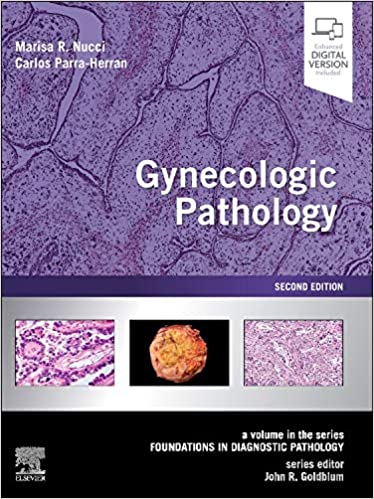 9780323359092 | Gynecologic Pathology: A Volume In Foundations In Diagnostic Pathology Series 2Ed | 9780323359092 | Together Books Distributor Gynecologic Pathology: A Volume In Foundations In Diagnostic Pathology Series 2Ed