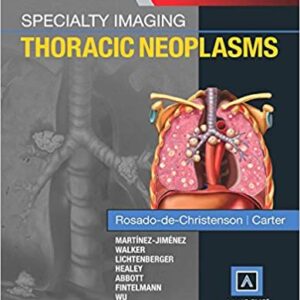 Specialty Imaging Thoracic Neoplasms Hb 2016 Amirsys Series
