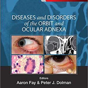 Diseases And Disorders Of The Orbit And Ocular Adnexa Hb 2017