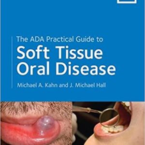 The Ada Practical Guide To Soft Tissue Oral Disease Pb 2014