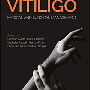 Vitiligo Medical And Surgical Management Hb 2018