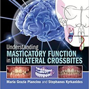 Understanding Masticatory Function In Unilateral Crossbites Pb 2016