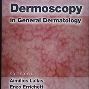 Dermoscopy In General Dermatology Hb 2018