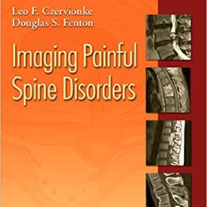 Imaging Painful Spine Disorders Hb 2011