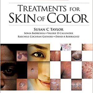 Treatments For Skin Of Color