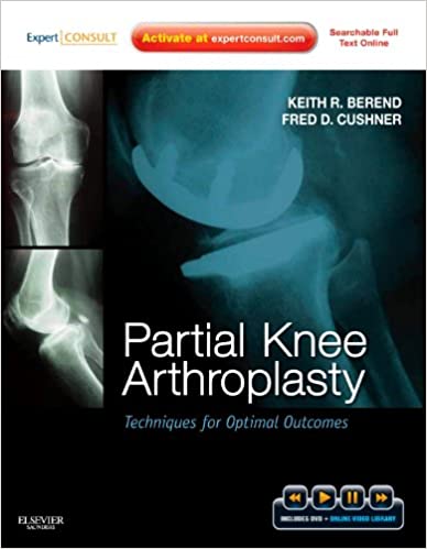 9781437717563 | Partial Knee Arthroplasty: Techniques For Optimal Outcomes | 9781437717563 | Together Books Distributor Partial Knee Arthroplasty: Techniques For Optimal Outcomes