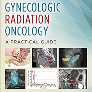 Gynecologic Radiation Oncology A Practical Guide Hb 2017
