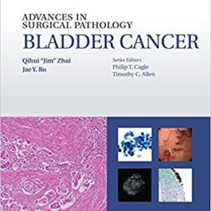 Advances In Surgical Pathology Bladder Cancer Hb 2016