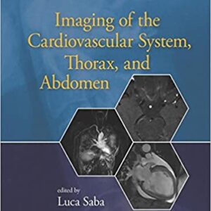 Imaging Of The Cardiovascular System Thorax And Abdomen Hb 2017