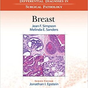 Differential Diagnoses In Surgical Pathology Breast Hb 2017
