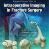 9781496328960 | Illustrated Tips And Tricks For Intraoperative Imaging In Fracture Surgery Hb 2018 | 9781496329004 | Together Books Distributor 9781496328960 | Illustrated Tips And Tricks For Intraoperative Imaging In Fracture Surgery Hb 2018 | 9781496329004 | Together Books Distributor