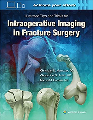 9781496328960 | Illustrated Tips And Tricks For Intraoperative Imaging In Fracture Surgery Hb 2018 | 9781496328960 | Together Books Distributor Illustrated Tips And Tricks For Intraoperative Imaging In Fracture Surgery Hb 2018