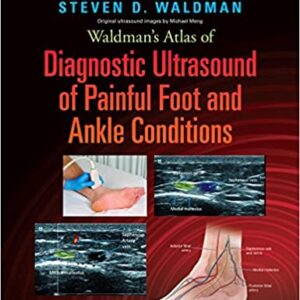 Waldmans Atlas Of Diagnostic Ultrasound Of Painful Foot And Ankle Conditions Hb 2016