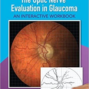 The Optic Nerve Evaluation In Glaucoma An Interactive Workbook Pb 2017