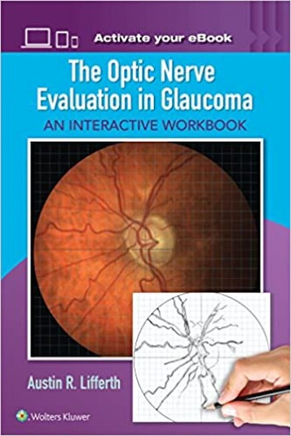 9781496363138 | The Optic Nerve Evaluation In Glaucoma An Interactive Workbook Pb 2017 | 9781496363138 | Together Books Distributor