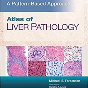 Atlas Of Liver Pathology A Pattern Based Approach Hb 2020