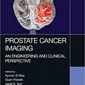 Prostate Cancer Imaging An Engineering And Clinical Perspective Hb 2019