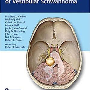 Comprehensive Management Of Vestibular Schwannoma With Access Code Hb 2019