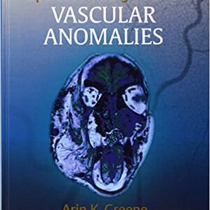 Operative Management Of Vascular Anomalies Hb 2017