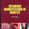 9781644350164 | Cutaneous Manifestations Of Diabetes Hb 2021 | 9781644350119 | Together Books Distributor