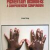 9781644350171 | Pigmentary Disorders A Comprehensive Compendium Hb 2021 | 9781644351338 | Together Books Distributor