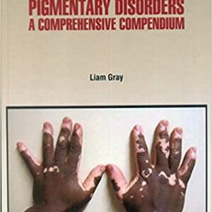 Pigmentary Disorders A Comprehensive Compendium Hb 2021