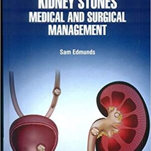 Kidney Stones Medical And Surgical Management Hb 2021