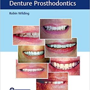 Case Guides To Complete And Partial Denture Prosthodontics With Access Code Pb 2020