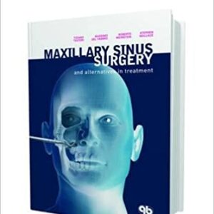 Maxillary Sinus Surgery And Alternatives In Treatment Hb 2009