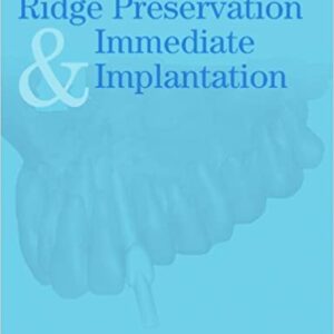 Ridge Preservation And Immediate Implantation Hb 2012