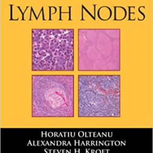 Lymph Nodes Pb 2013