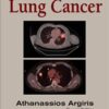 9781936287529 | Lung Cancer Hb 2012 | 9781936287550 | Together Books Distributor