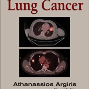 Lung Cancer Hb 2012