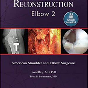 Advanced Reconstruction Elbow 2 American Shoulder And Elbow Surgeons Hb 2016